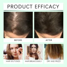 Hoegoa Rosemary Hair Oil