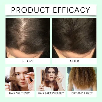 Hoegoa Rosemary Hair Oil Hoegoa Rosemary Hair Oil