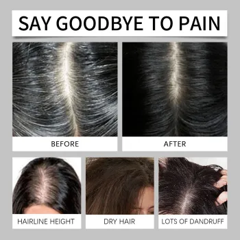 Hoegoa Rice Water Shampoo Hoegoa Rice Water Shampoo